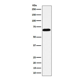 Anti-Intestinal Alkaline Phosphatase / ALPI, clone AEGC-1