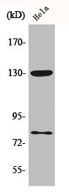 Anti-Phospho-ADD1/ADD2 (S726/713)
