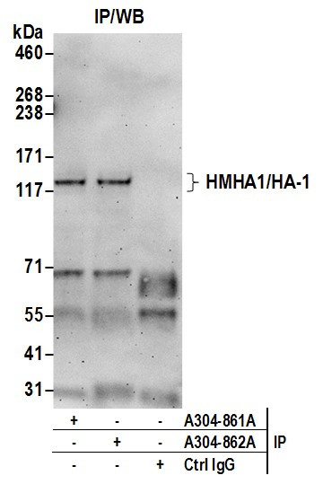 Anti-HMHA1/HA-1