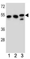 Anti-TUBB6 (Tubulin beta 6)