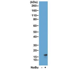 Anti-H3K27ac / Acetyl Histone H3 Lysine 27, clone RM172 (recombinant antibody)