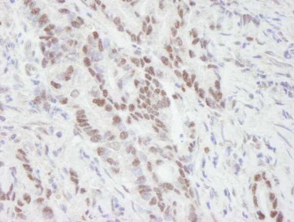 Anti-MTA1 (IHC)