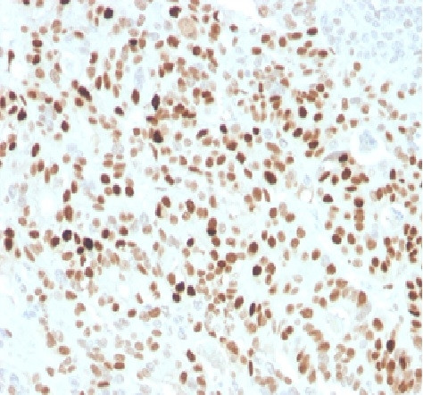 Anti-p21WAF1 (Tumor Suppressor Protein), recombinant antibody, clone CIP1/4377R