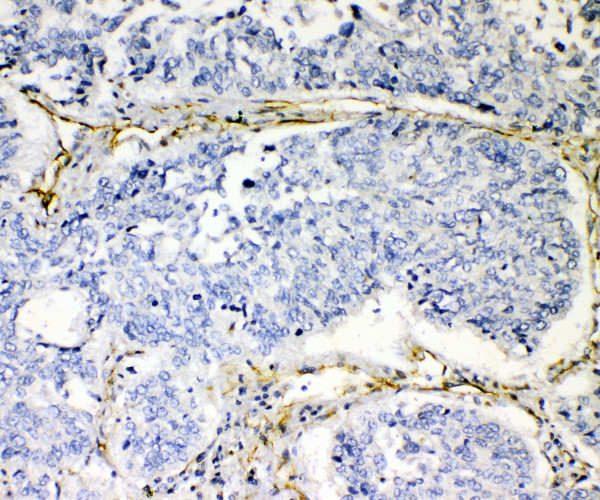 Anti-VE Cadherin