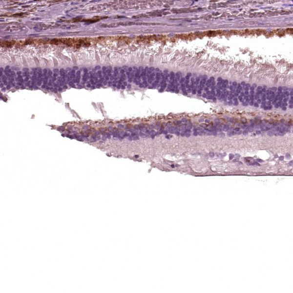 Anti-TRPM1