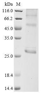 Aquaporin-5 (AQP5), human, recombinant