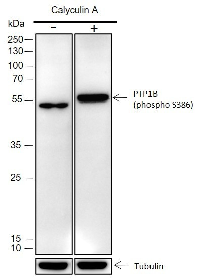 Anti-Recombinant Phospho-PTP1B (Ser386), clone A346