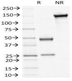 Anti-Desmoglein 3, clone 5H10