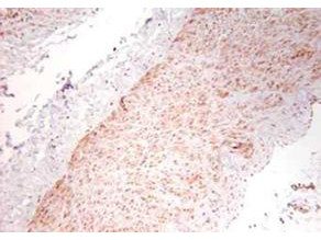 Anti-Tumor Necrosis Factor alpha (TNFa)