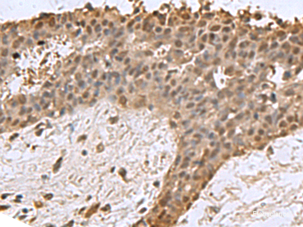 Anti-DCTPP1