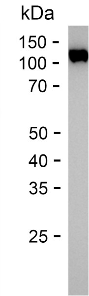 Recombinant Human MPO Protein