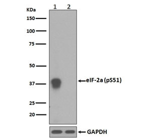 Anti-phospho-EIF2S1 (Ser51), clone IO-5