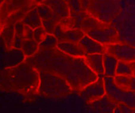 Anti-TROP2, clone M005