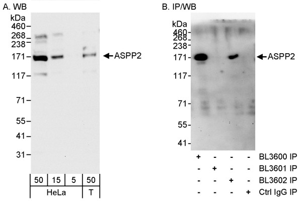 Anti-ASPP2