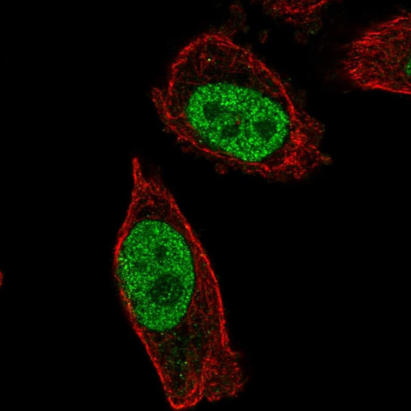 Anti-ABHD16B