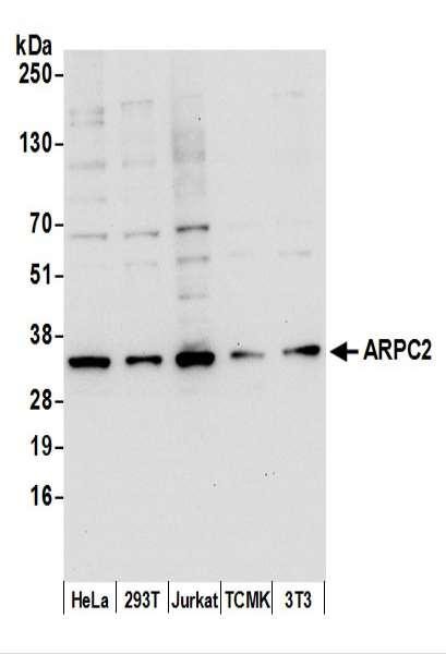 Anti-ARPC2