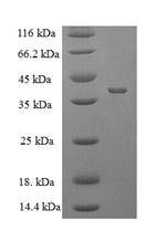 Protease 7 (ompT), Escherichia coli, recombinant