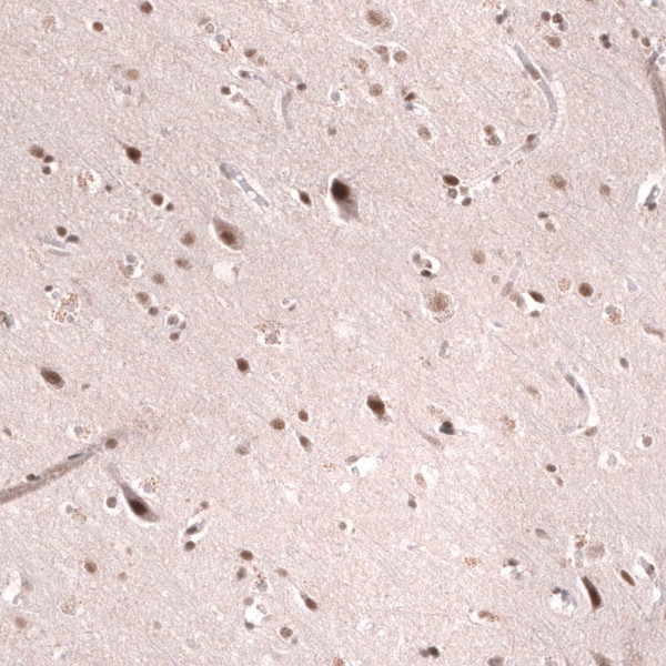 Anti-SMARCB1, clone CL14017