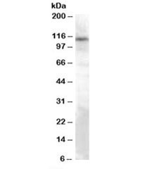 Anti-TRPC4