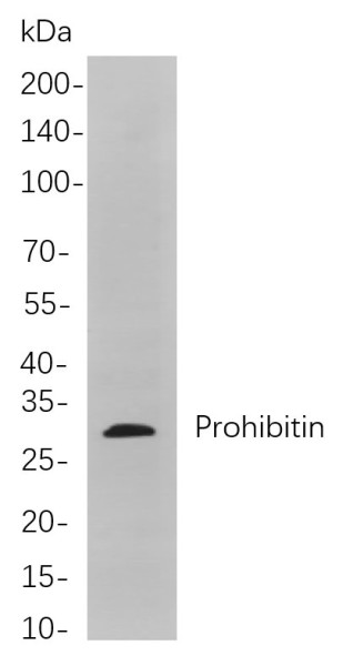 Anti-Recombinant Prohibitin, clone 7F13