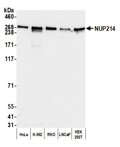 Anti-NUP214