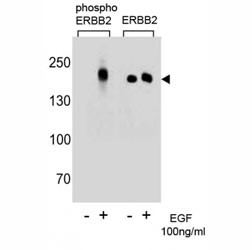 Anti-p-ERBB2 (pY1196)