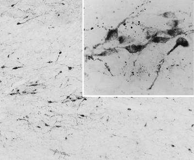 Anti-AGRP / Agouti-related protein