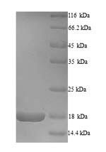 Envelope glycoprotein (GP), partial, Sudan ebolavirus, recombinant