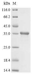 Spike glycoprotein (S), partial, Feline coronavirus, recombinant