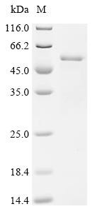 Cardiolipin synthase A (clsA), partial, Escherichia coli O6:H1, recombinant