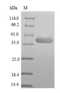 Outer capsid protein VP4, partial, Rotavirus A, recombinant