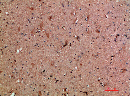 Anti-CLCF1