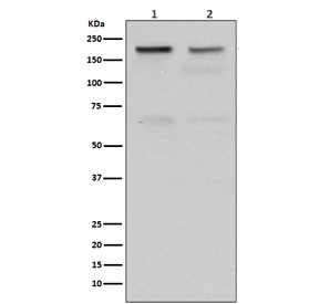 Anti-Topoisomerase II alpha / TOP2A, clone FB-20