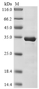 Zinc finger and BTB domain-containing protein 32 (ZBTB32), partial, human, recombinant