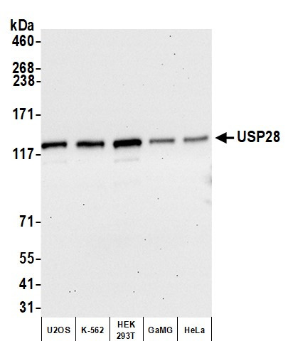 Anti-USP28