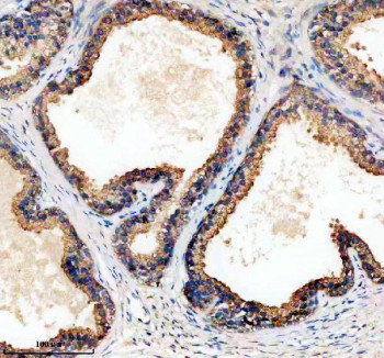 Anti-TPD52 / Tumor protein D52