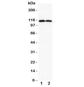 Anti-DOG1 (TMEM16A)