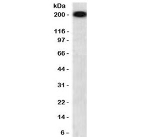Anti-Neurofilament (-Heavy) / NF-H / NEFH, clone NFHP-1R