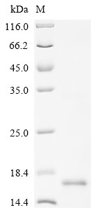 Lymphocyte antigen 6E (LY6E), human, recombinant