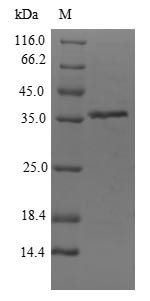 Dihydroxyacetone kinase (dhaK), partial, Citrobacter freundii, recombinant