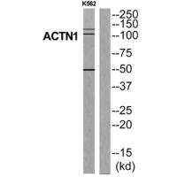 Anti-ACTN1