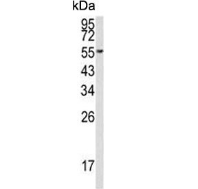 Anti-EEF1A1/2