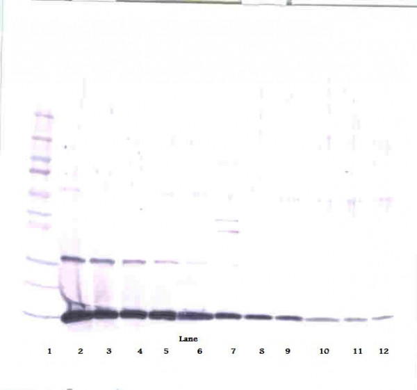 Anti-GM-CSF