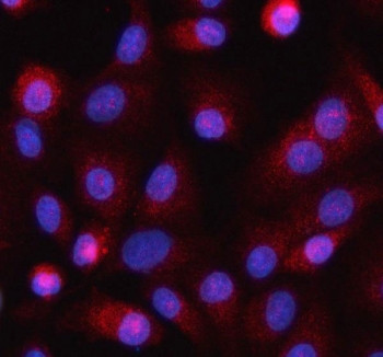 Anti-HELZ / Helicase with zinc finger