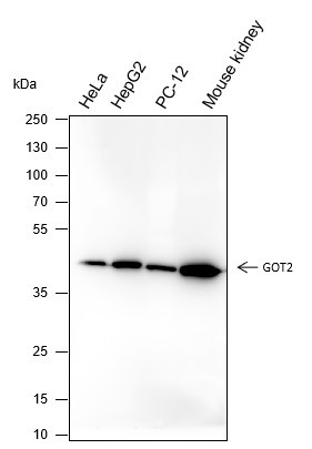 Anti-Recombinant GOT2, clone A237