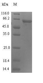 Syncytin-1 (ERVW-1), partial, human, recombinant