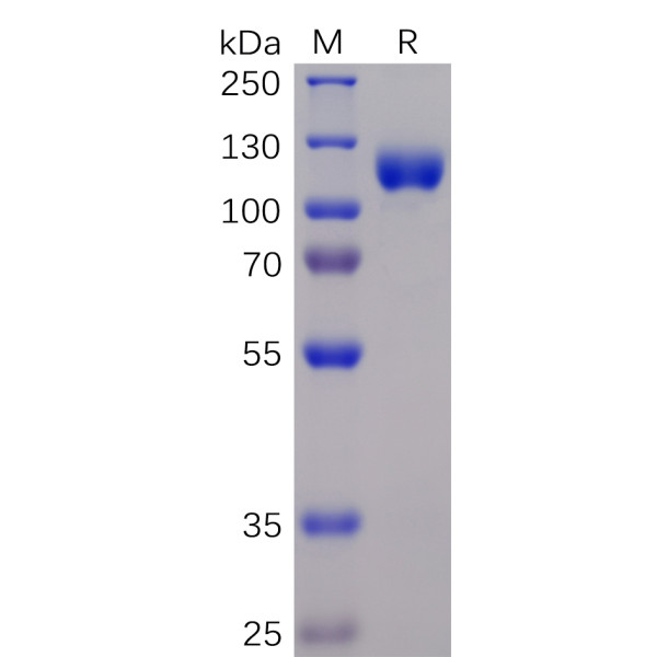 Human EPHA3 Protein, mFc-His Tag