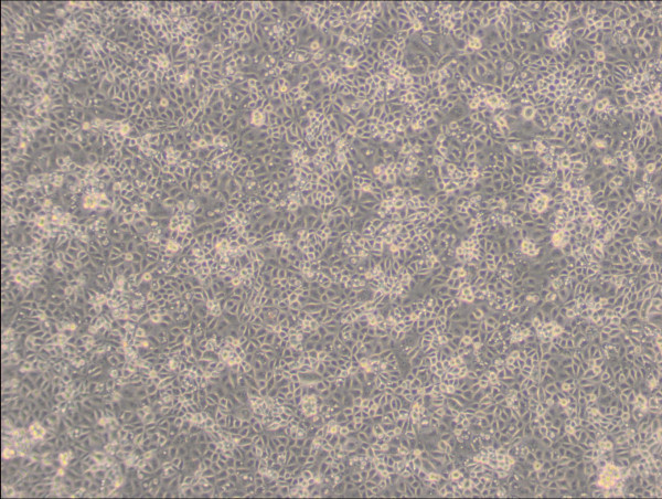 ST Cells