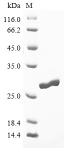 Cathepsin L2, partial, Fasciola hepatica, recombinant