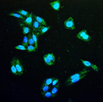 Anti-IDH1 / Isocitrate Dehydrogenase, clone 16H7